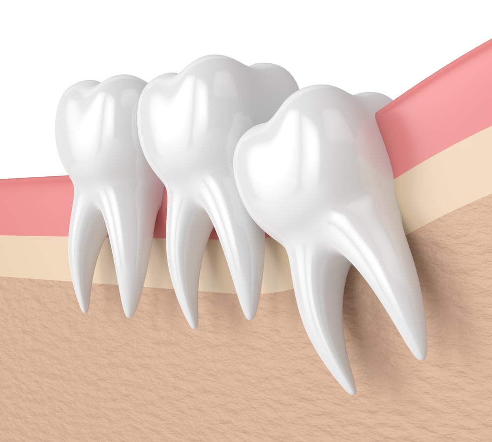 molar teeth