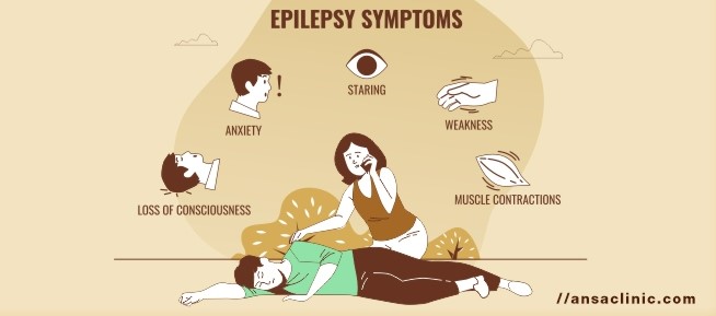 Epilepsy symptoms medicals