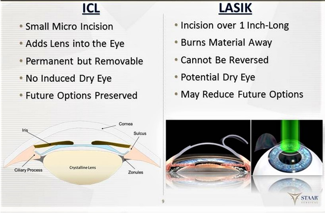 ICL Surgery Vs LASIK Surgery