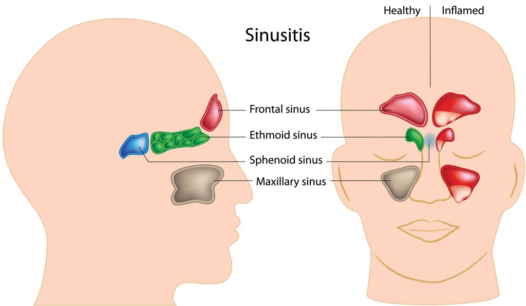 sinus