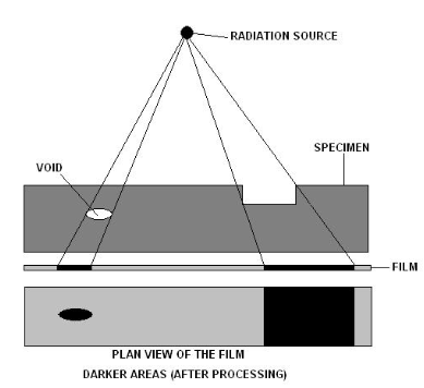 Radiography